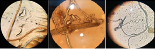 Figure C: Microplastic fibres detected in the Hawkse bay beach sediment under microscope © Muhammad Faisal, IMS-UoK